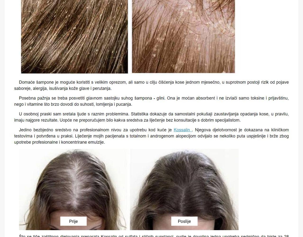 Kossalin šampon hair 5