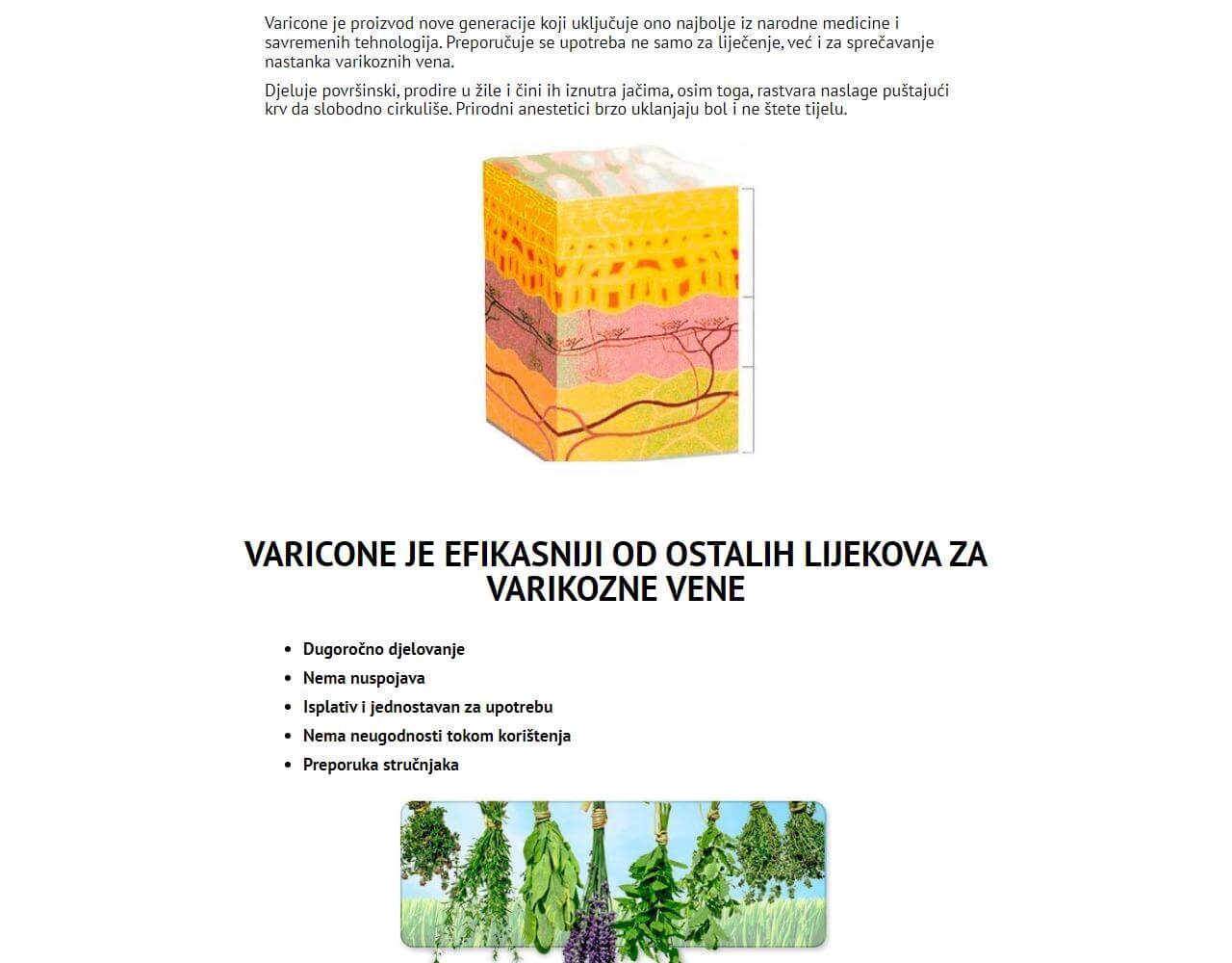 Varicone 4